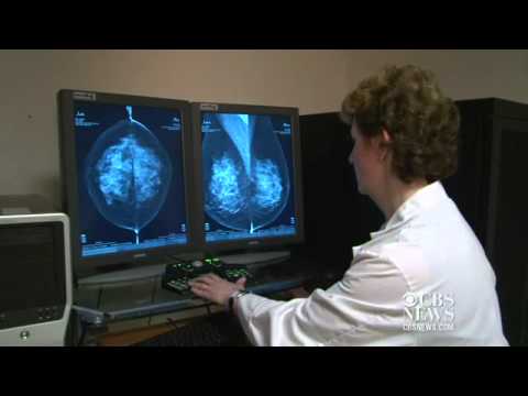 Tamilong 20mg Tablets