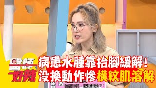 病患水腫靠抬腳緩解！沒換動作慘橫紋肌溶解！【#醫師好辣】20250629 E1736 part4