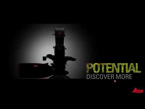 Nanoscopy Meets Lifetime   Introducing the new STELLARIS 8 τ STED 1