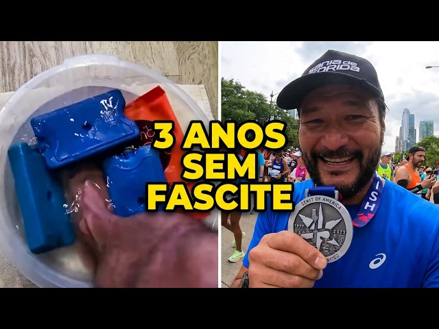 A Fascite Plantar voltou?