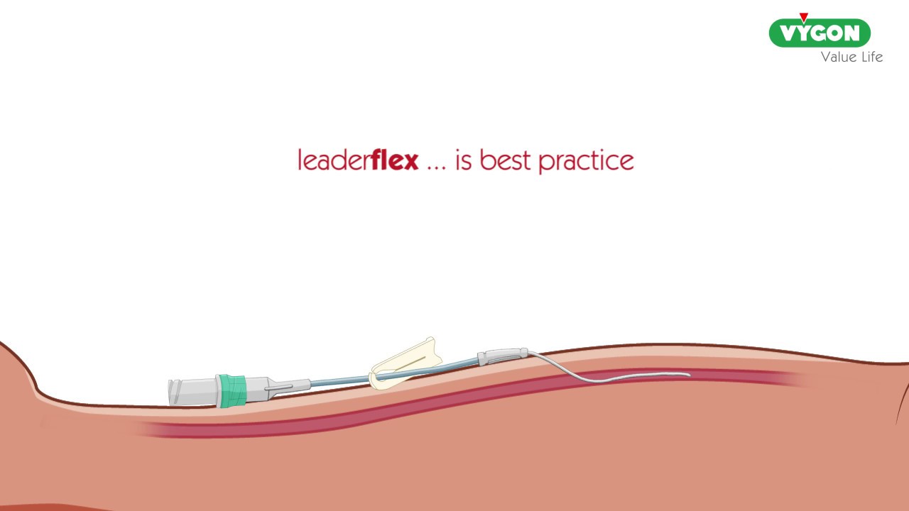 Leaderflex Insertion Technique