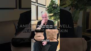 AirSculpt Seattle surgeon Dr. Bullis talks to us about the inspiring journey of one of his patients
