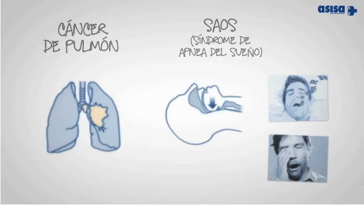 Giovanni Alvear Urzua-31