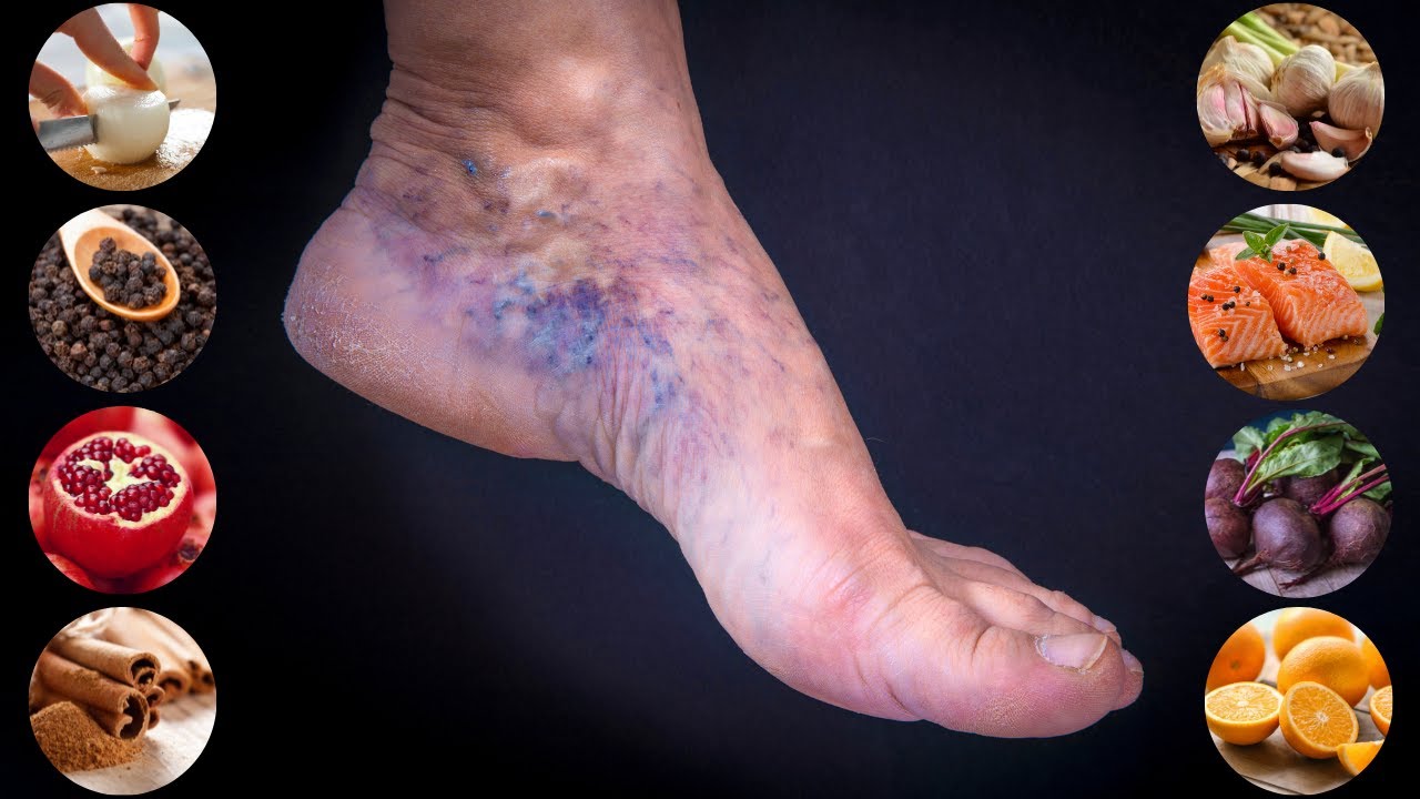 🍊8 ALIMENTOS para MEJORAR LA CIRCULACIÓN de las piernas