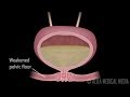 Stress Urinary Incontinence In Women Animation