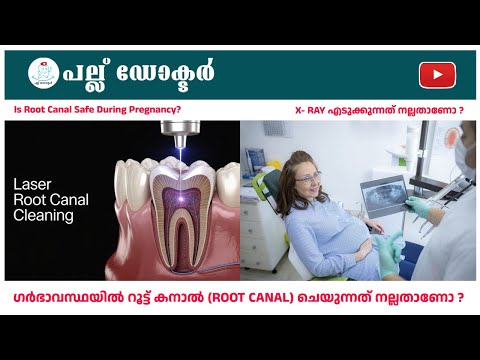 ഗർഭാവസ്ഥയിൽ Root Canal Treatment (RCT) ചെയ്യുന്നതു സുരക്ഷിതമാണോ?Is Root Canal Safe During Pregnancy?