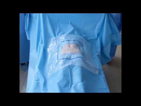 Disposable Sterile Surgical Drape