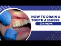 How To Drain A Tooth Abscess At Home Using Home Remedies