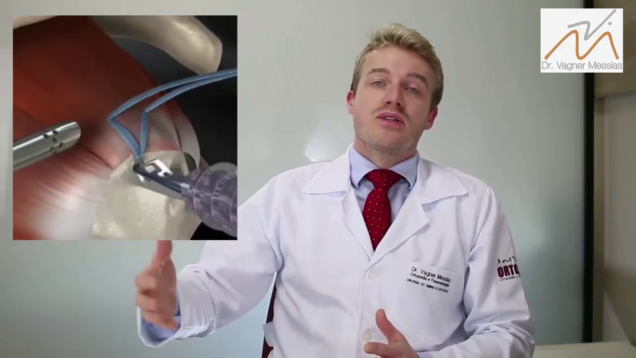 Vagner Messias Fruehling-39