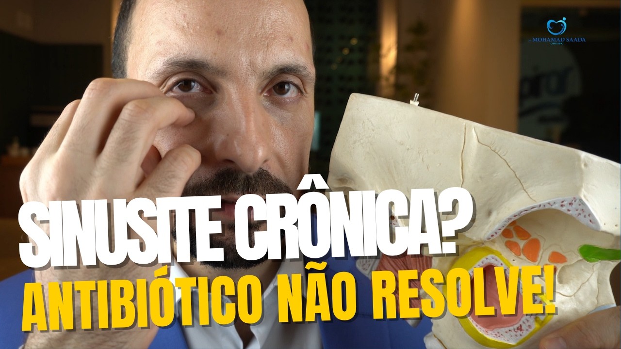 CIRURGIA DE SINUSITE: COMO FUNCIONA DE VERDADE