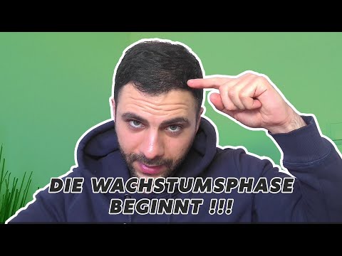 Haare fangen an zu wachsen ! Haartransplantation Update