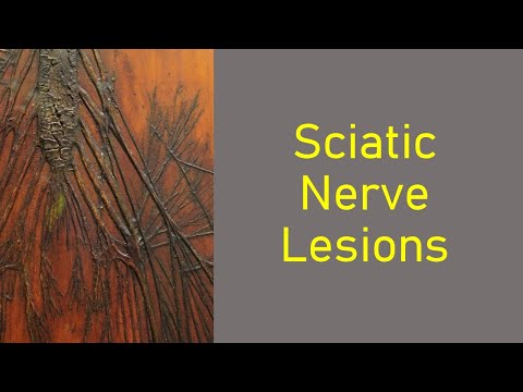 Sciatic Nerve Lesions (Part 1)