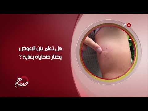 شاهد بالفيديو.. صباح الشرقية 19-6-2019 | هل تعلم بان البعوض يختار ضحاياه بعناية؟