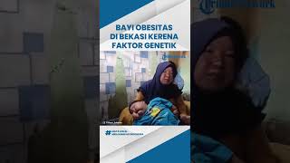 Kenzi Si Bayi Obesitas di Bekasi Dirujuk ke RSCM, Dokter: Terdapat Faktor Genetik & Penyakit Langka