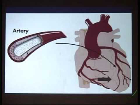 public lecture : Be Heart Wise ( 27/09/2014 )