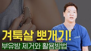 겨툭살 뽀개기! 부유방 제거와 활용방법
