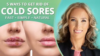 Cold Sores | 5 Ways to Get Rid of Cold Sores Overnight | Dr. J9 Live