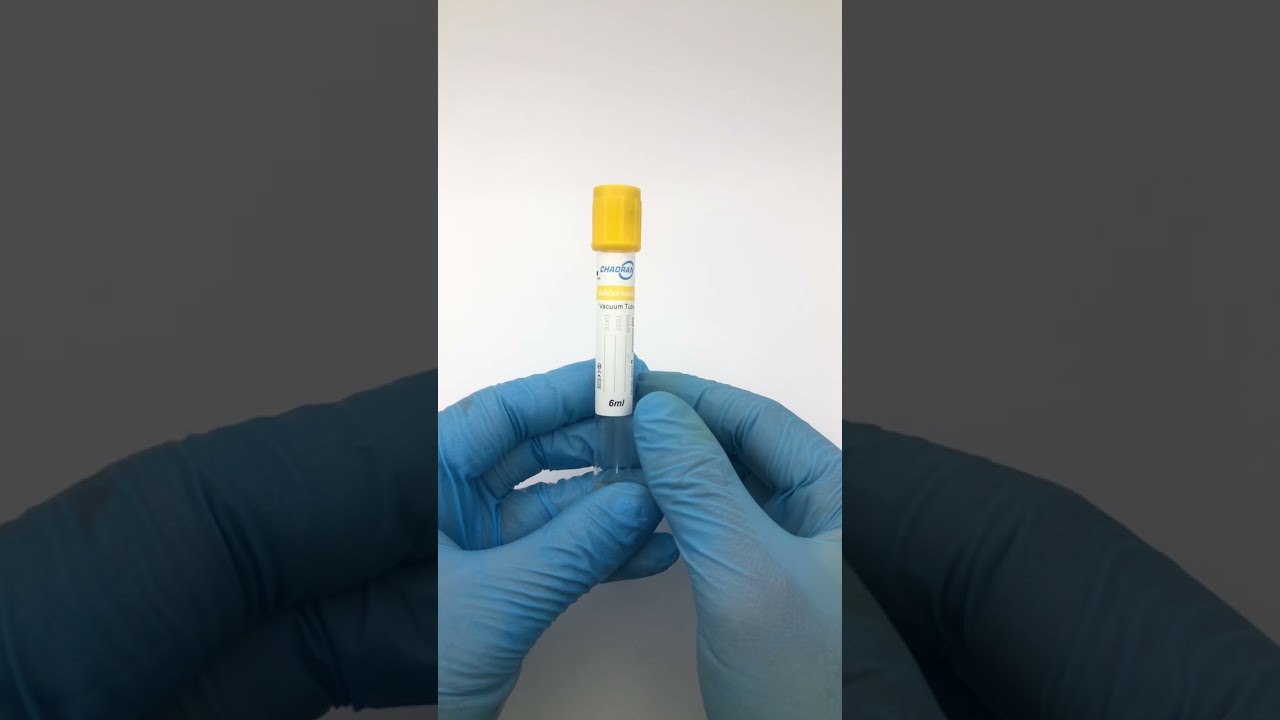 Vacutainer Gel&clot Activator blood collection tube