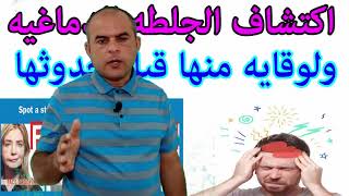 اصبع الزناد الاسباب الاعراض العلاج موضوع شامل ومبسط Samye