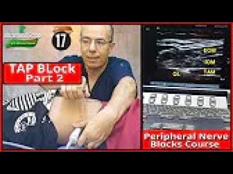 Basic Physics of Ultrasound Part 1 Mohamed Hamada 1