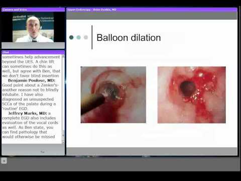 Upper and Lower Endoscopy: Endoscopic Management of Surgical Disease