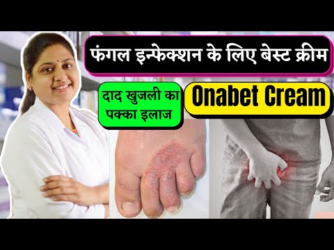 Sertaconazole Onabet Cream 2% w/w for Skin (30 g)