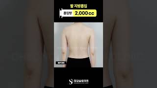 운동 안하고 팔이 이렇게 얇아진다고?