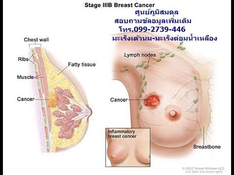 สิ่งที่ยาเพิ่มหน้าอก บางหน้าอกเล็กโป๊