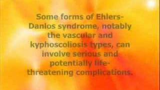 Ehlers-Danlos Syndrome.... Nothing Hurts in my World.