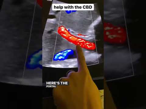 Finding the CBD