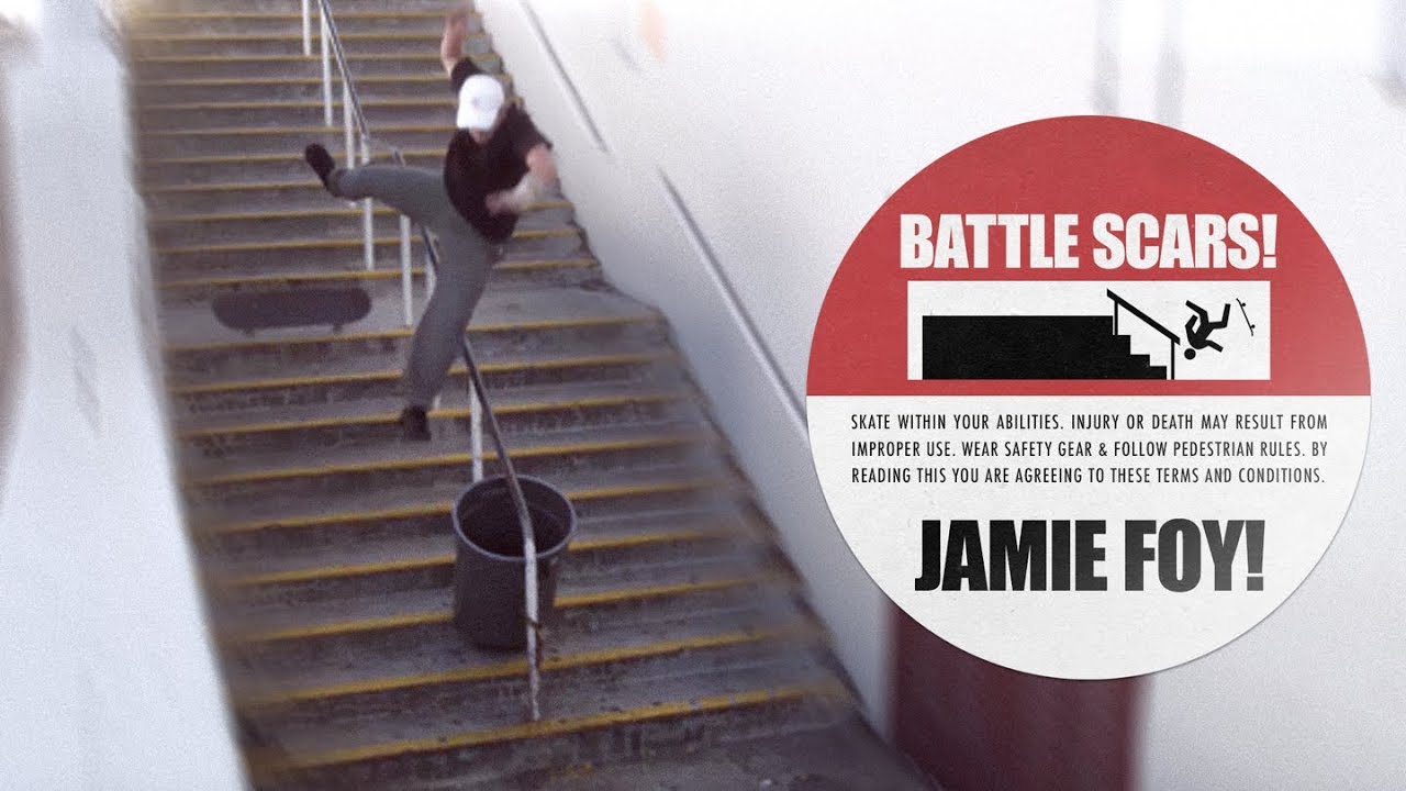 Jamie Foy habla sobre sus peores caídas