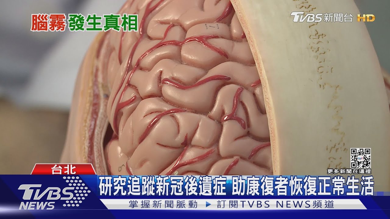 上課狂斷片被學生笑腦霧後遺症好苦　英研究：新冠病毒致大腦萎縮