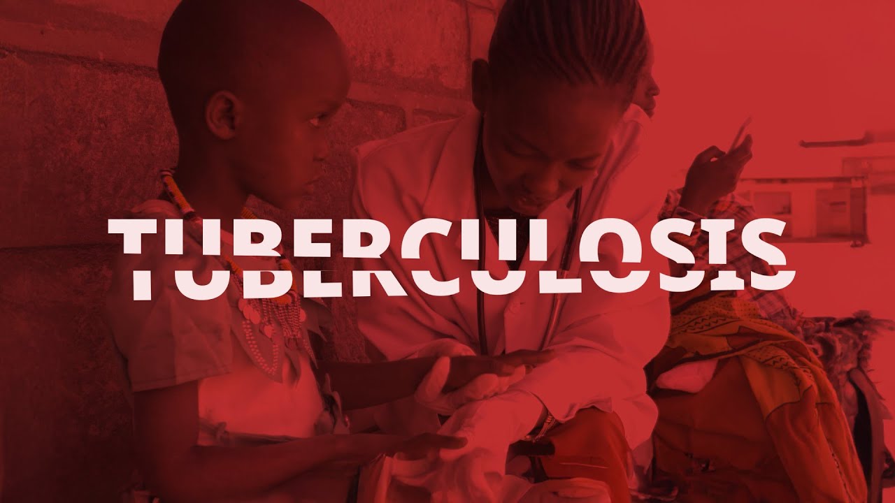 The devastating impact of cutting America's anti-TB efforts