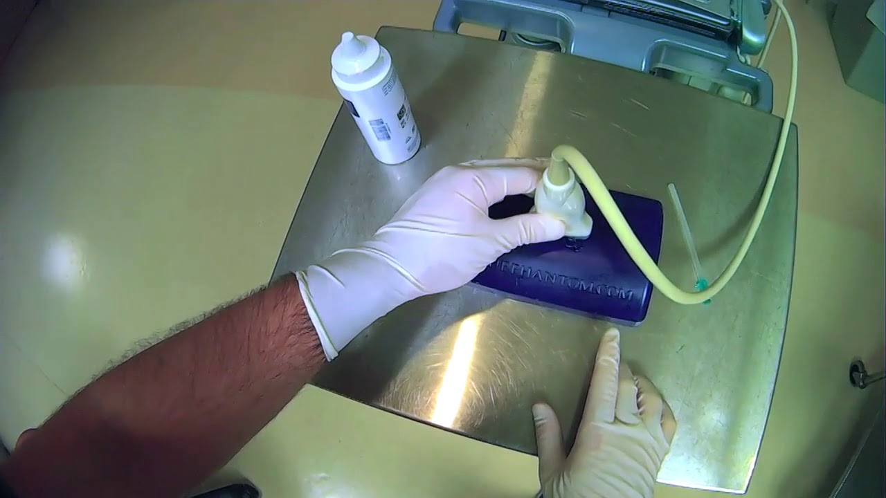 5 Orienting Your Probe