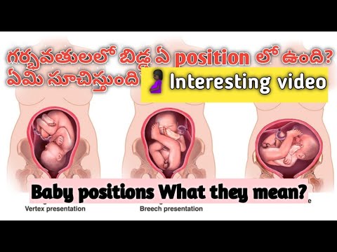 Baby position during pregnancy and what they mean/Normal delivery position in telugu