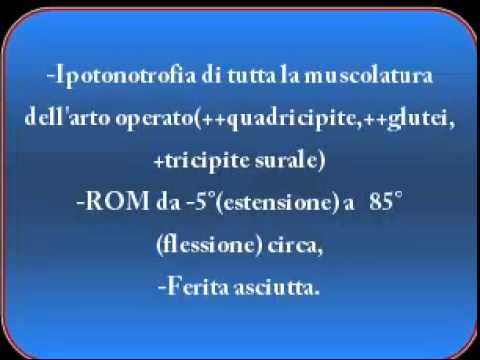 Sudore mentre giunti rigidi Callo sul gomito