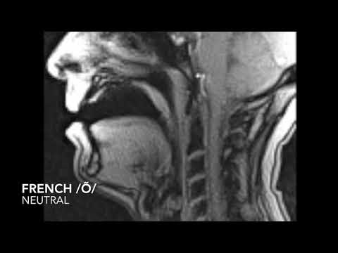 MRI Video of Soft Palate Movement