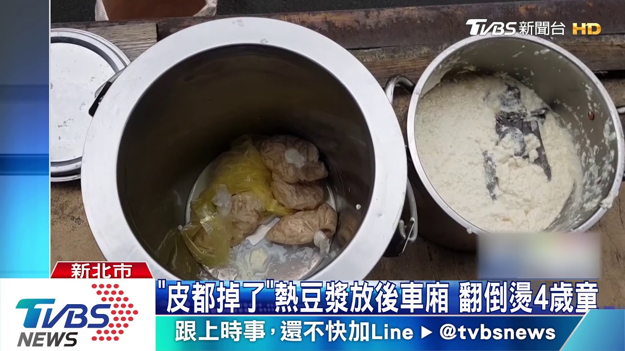 「皮都掉了」熱豆漿放後車廂 翻倒燙4歲童