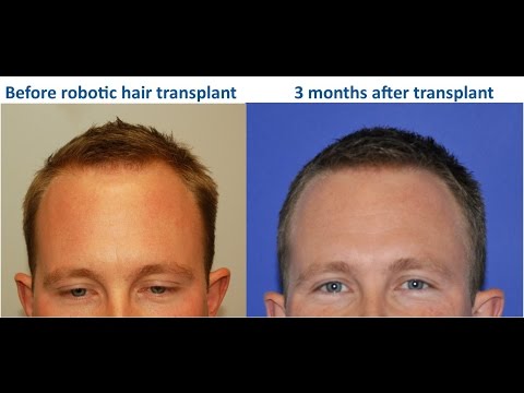 Testimonials – Anderson Center for Hair in Alpharetta & Atlanta, GA Testimonials – Anderson Center for Hair in Alpharetta & Atlanta, GA
