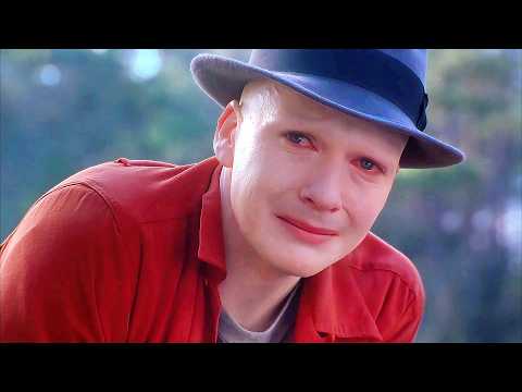 A Boy Struck by Lightning at Birth… What He Becomes Will Shock You