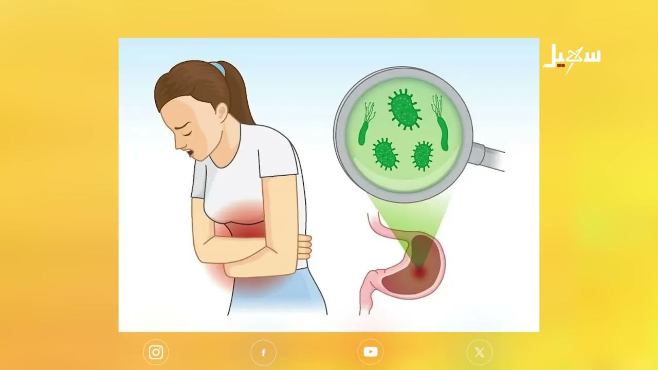 جرثومة المعدة مرض صامت قد يطول معاناته