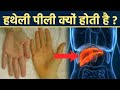 हथेली पीली क्यों होती है हथेली पीली हो