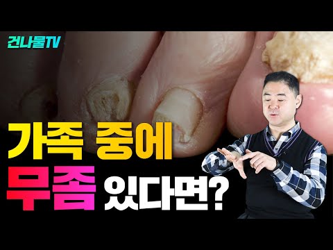 , title : '무좀 없애고 싶다면 이렇게 하세요! 완벽치료방법'