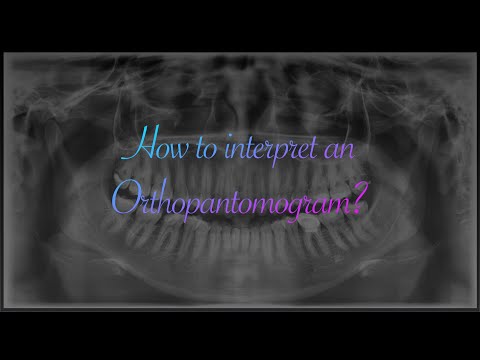 How to Interpret an OPG (Orthopantomogram) ?