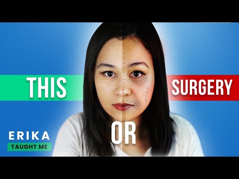 Dr. Anthony Youn: Get A Younger Face Without Surgery!