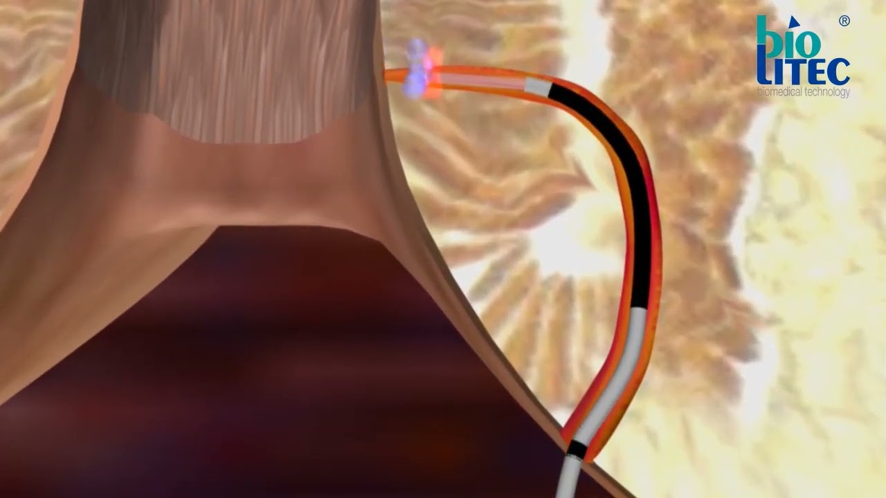 Antonio Bergantino-11