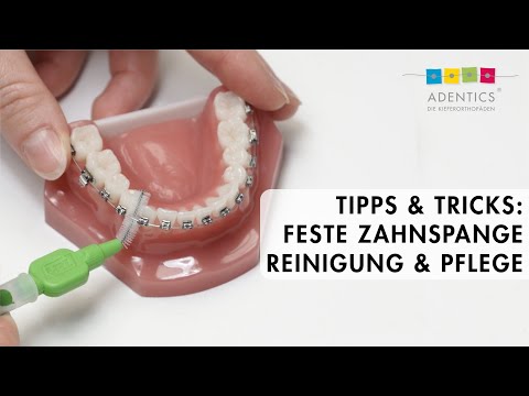 FESTE ZAHNSPANGE  – Tipps & Tricks zur Reinigung und Pflege