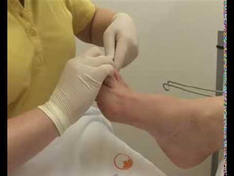 Große Lymphknoten im Nacken verletzt Deep Relief Osteochondrose