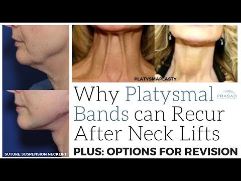Why Neck Bands can Recur after a Neck Lift, and its Minimally Invasive to Full Surgical Treatments
