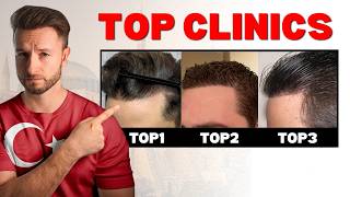 TOP 7 Hair Transplant Surgeons in Turkey for 2026!